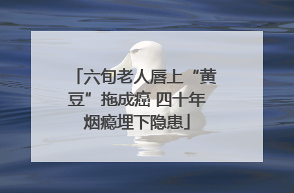 六旬老人唇上“黄豆”拖成癌 四十年烟瘾埋下隐患