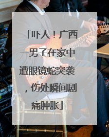 吓人！广西一男子在家中遭眼镜蛇突袭，伤处瞬间剧痛肿胀